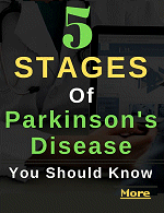 Parkinsons disease is a progressive and highly variable brain disorder that affects movement. The rate at which the disease progress varies from one person to another. Some develop disease complications early; others face them late. Disease progression also depends on age. Usually, the disease advances more slowly in young people.